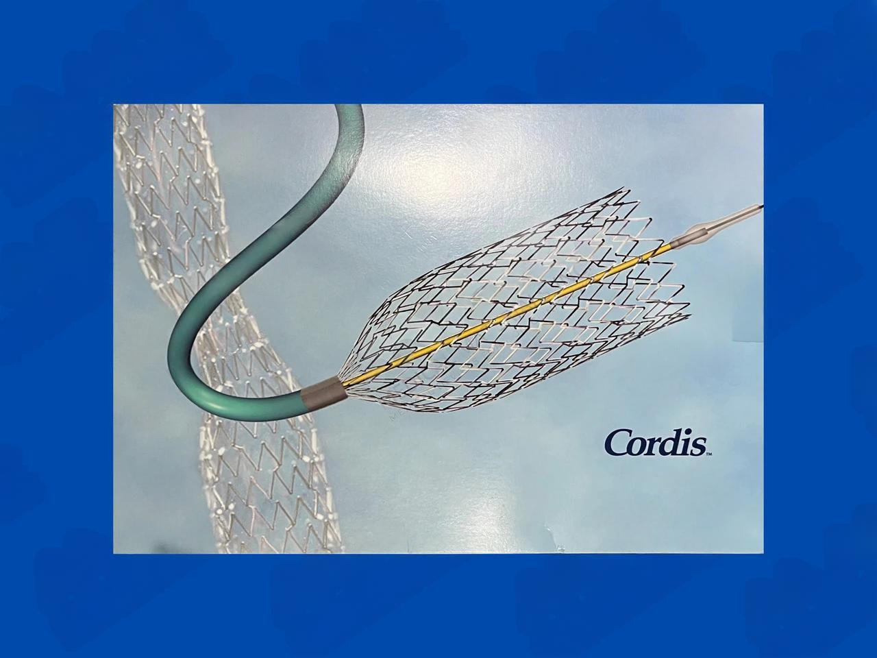 PRECISE PRO Rx Nitinol Carotid Stent System - 5mm x 30mm x 135cm
